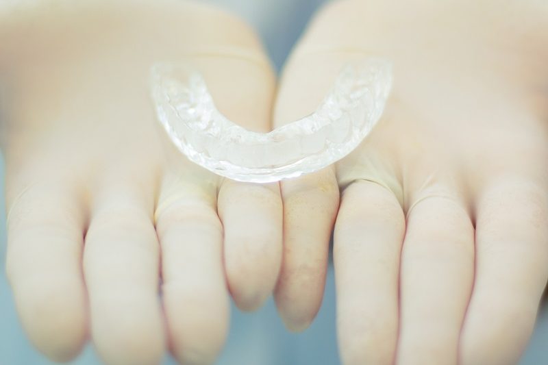 Different Types of Retainers